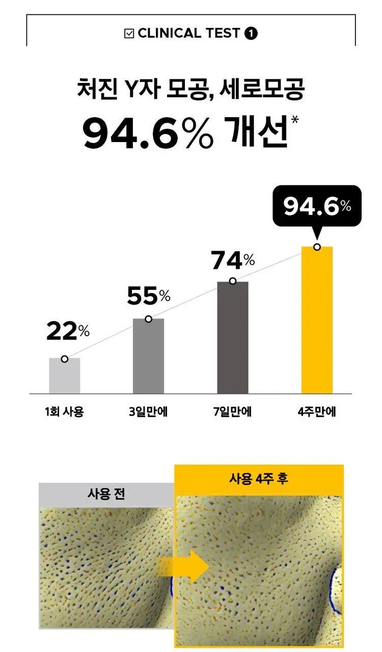 [7월올영픽] 프리메라 세럼 3종 기획 (비타티놀/3C히알루론산/PDRN) 택1 상세페이지 11